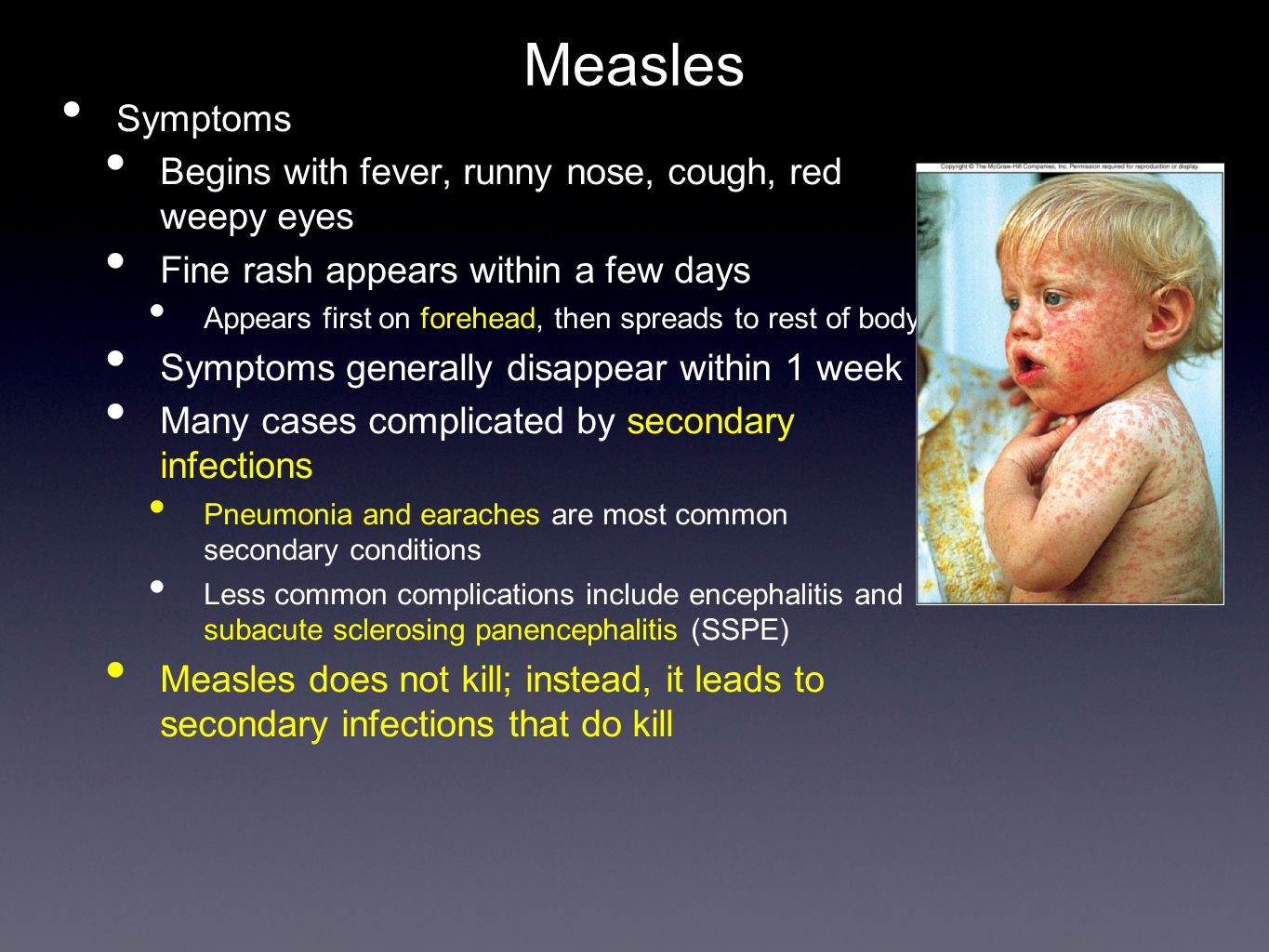 Measles презентация на английском